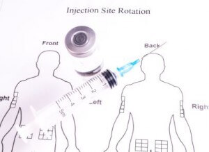 insulin injection site rotation chart