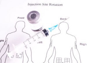 Printable Insulin Injection Site Rotation Chart